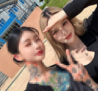 유깻잎, 성형 수술 후 확 달라진 얼굴 “부기 차이 미쳤다”