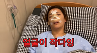 ‘코 재수술’ 받은 고은아, 얼굴에 붕대 칭칭..남동생 미르 “수술 잘 됐다”(방가네)