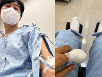 도경완, 깜짝 손가락 수술 소식..♥장윤정 병수발에 ‘감동’