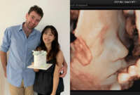 ‘아빠 닮았나?’ 임현주 아나, 오뚝한 콧날 태아초음파 공개