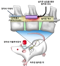 자생한방병원, 한방 천연물로 척추관협착증 치료 효과 입증