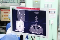 한림대동탄성심병원 박태환 교수, 안면골절 내비게이션 수술 효과 입증