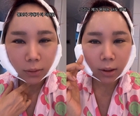 ‘강원래♥’ 김송, 광대 수술 후 퉁퉁 부은 얼굴..“45도 광대 살짝 넣어”