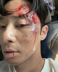 ‘경성크리처’ 박서준, 피 흘리는 촬영 현장 “part 2. 많.사.부”