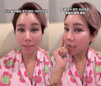 김송, 광대 수술 후기 “만족도 100%, 아픔 없고 불편함만 있을 뿐”