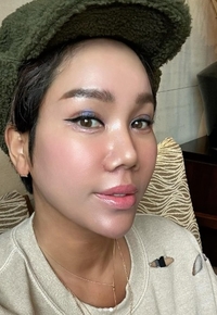 ‘강원래♥’ 김송, ‘광대 수술’ 얼마나 됐다고 ‘인중 축소수술’까지..“불편해서 웃지 못해”