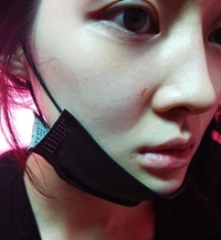 티아라 아름, 前남편 폭행 흔적 공개..“코뼈 휘고 피멍 들어”