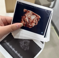 김다예 딸, 벌써 ♥박수홍 판박이..16주에 벌써 코가 오똑