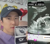 장수원, 딸바보 아빠 예고..딸 초음파 사진 자랑