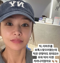 배윤정, 다이어트 성공 이어 보톡스 중단...“이제 턱이 안자란다”