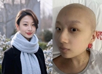 “나 예뻐?” 암 투병 손녀가 보낸 AI 사진…할머니 안심시킨 ‘하얀거짓말’