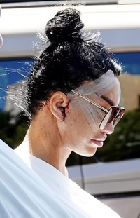 거액 탈세 英모델, 6번째 안면거상술로 충격적인 등장[할리웃톡]