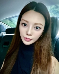 ‘음주운전 자숙’ 리지, 너무 달라진 얼굴에 성형설…“턱 안깎았다” 부인