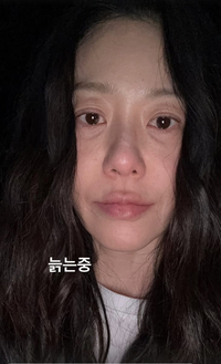 고현정, 수술 후 핼쑥해진 모습도 당당 공개