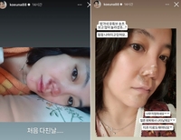 “나 어떡해! 얼굴로 먹고사는 얜데” 고은아, 빙판길 낙상사고로 만신창이