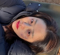 ‘얼굴에 멍투성이’ 고현정 대체 무슨일이?…이제 늦잠 자고 싶다!