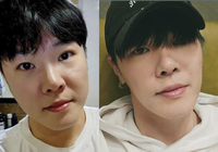 성형이야 다이어트야? 휘성, 붓기 빠진 모습 공개