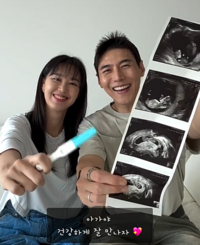 송재희♥지소연, 유산 아픔 딛고 둘째 임신 “시험관으로 만나”