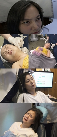 박나래, 탈모 고민 있었다 “인정하기까지 시간 걸려”(‘나혼산’)