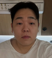 문상훈, 목 건강 적신호 “성대 수술…당분간 말 못해”