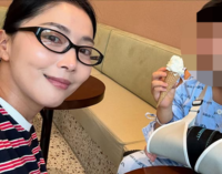 오윤아, “너무 막막해” 발달장애 아들 팔 골절 수술 근황 [★SNS]