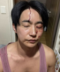 뮤지컬스타의 두 얼굴?, 전호준 “정당방위” vs 前여친 “폭행·갈취·성병”…SNS폭로전