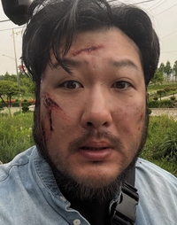 그 ‘김대호’ 아닌 배우 김대호, 말라리아 걸려 40도 고열에 일주일째 고군분투