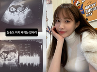 “짐승도 자기 새끼 안 버려”…‘임신 폭로’ 서민재, 초음파 사진 추가 공개