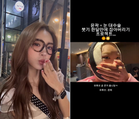 故 최진실 딸 최준희, 광대수술 후 근황 공개…“붓기 한 달 만에 싹 빠져”