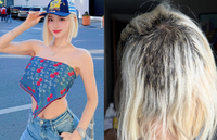 “머리 10% 남아” DJ 소다, 더 충격적인 탈색 사고 근황 [★SNS]