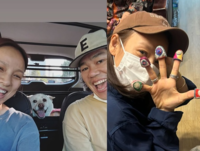 “손가락이 덜렁덜렁, 잘린 줄!” 이효리…‘반려견 사랑이 부른 아찔 사고’