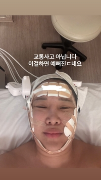 랄랄, 얼굴에 붕대 칭칭 감고…“나 교통사고 났어”