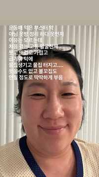 개그우먼 김영희, 갑작스런 알레르기 쇼크로 응급실행