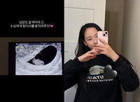 혜박, 결혼 17년만 둘째 임신→두 차례 유산 고백 “심장소리에 행복 밀려와”