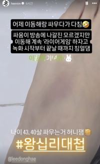 김희철, 동해와 다퉜다...멍든 다리 공개 [★SNS]