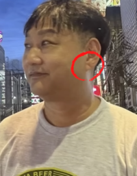 ‘급성 심근경색’ 김수용, 귓볼 주름 전조증상 맞았나