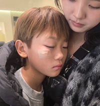 이동국 막내 시안, 얼굴 깊은 상처에 6바늘…“흉터날까 걱정”