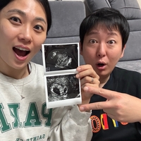 ‘펜싱’ 김지연, 배우 이동진과 결혼 9년 만에 ‘쌍둥이 임신’…“태명은 럭키·비키”