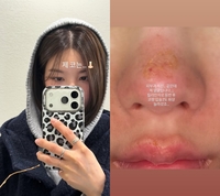 저게 권은비 코라고?…무슨 일 [★SNS]