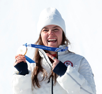 “기뻐서 뛰었더니 메달 부서져”…녹슬고 부식은 애교였나, 명품 올림픽이라더니 품질 논란 ‘또’ [2026 밀라노]