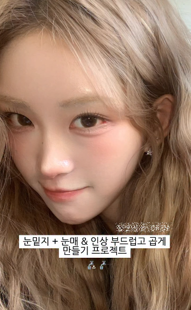 '11살 연상♥' 최준희, 5월 결혼 앞두고 2차 눈 성형수술 "너무 만족"