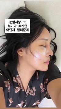랄랄 맞아? 성형수술 후 ‘오똑 콧날’로 확 바뀐 얼굴 공개