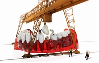 효도 치과 치료의 변화…임플란트에서 인상 개선까지 [SS포커스]