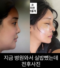 랄랄, 성형 전후 사진 깜짝 공개... “원래 예쁘면 고치지 마라” 소신 발언