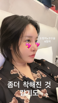 랄랄, 코 성형+눈밑지 고백 “착해진 느낌”...미모 리즈 경신?