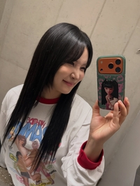 ‘눈밑지’ 및 코 성형 수술 랄랄, “일주일 됐는데 어떤가요”