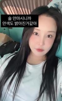 확 달라진 랄랄, 눈 성형 후 금주 9일 만에 3kg 감량까지! “안색 밝아졌다”