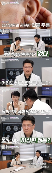 “귓불 주름이 뇌졸중 전조증상? 의학적 미신”…김수용 귓불주름 진실