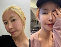 “레이저 범벅 얼굴 어디로?” S.E.S 슈, 붉은 기 쏙 빠진 미모 근황