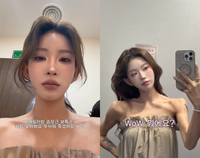 ‘故 최진실 딸’ 최준희, 5월의 신부 변신 앞두고 ‘어깨 시술’ 고백